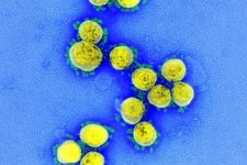 Đột biến 'bí ẩn' của virus SARS-CoV-2