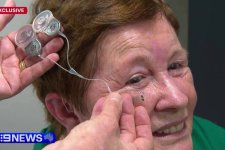 Tin Úc: Thử nghiệm mắt sinh học giúp khôi phục thị giác cho người khiếm thị