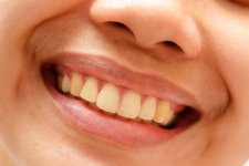 Lý do không ngờ khiến bạn đánh răng đều mỗi ngày nhưng răng vẫn ố vàng