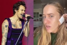 Queensland: Cô gái thủng màng nhĩ sau khi xem concert của Harry Styles