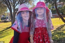 Hai bé gái mắc bệnh nhạy cảm với ánh nắng ở Sydney