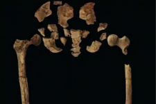Bộ xương 31.000 năm tuổi từng phẫu thuật cắt cụt chi