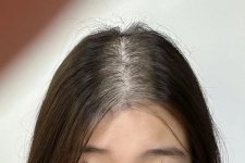 Nguyên nhân gây rụng tóc sớm và cách cải thiện