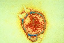 New South Wales: Phát hiện chủng mới của virus Hendra ở dơi quạ