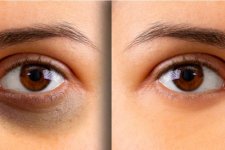 Chăm sóc da mắt bằng phương pháp truyền thống: Làm đẹp tự nhiên từ bên trong