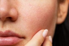 Nguyên nhân và cách điều trị tình trạng da khô