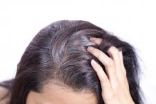 Nguyên nhân và cách khắc phục tình trạng tóc bạc sớm