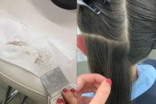 Sydney: Thợ làm tóc chải ra hàng trăm trứng chí khiến nhiều người không khỏi bàng hoàng
