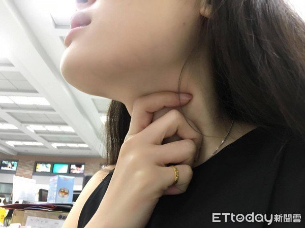 Nữ sinh mắc sùi mào gà trong cổ họng khẳng định chưa quan hệ, nguyên nhân gây bất ngờ - 1