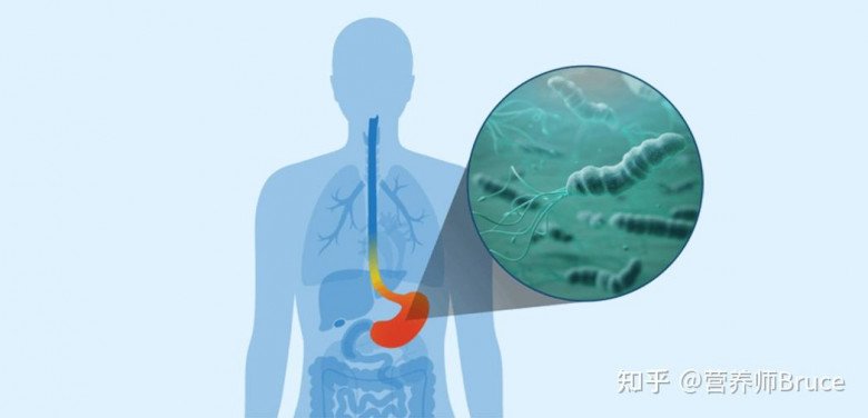 Gia đình 5 người mang mầm mống ung thư, 1 người mắc K dạ dày vì có chung thói quen ăn uống này - 3