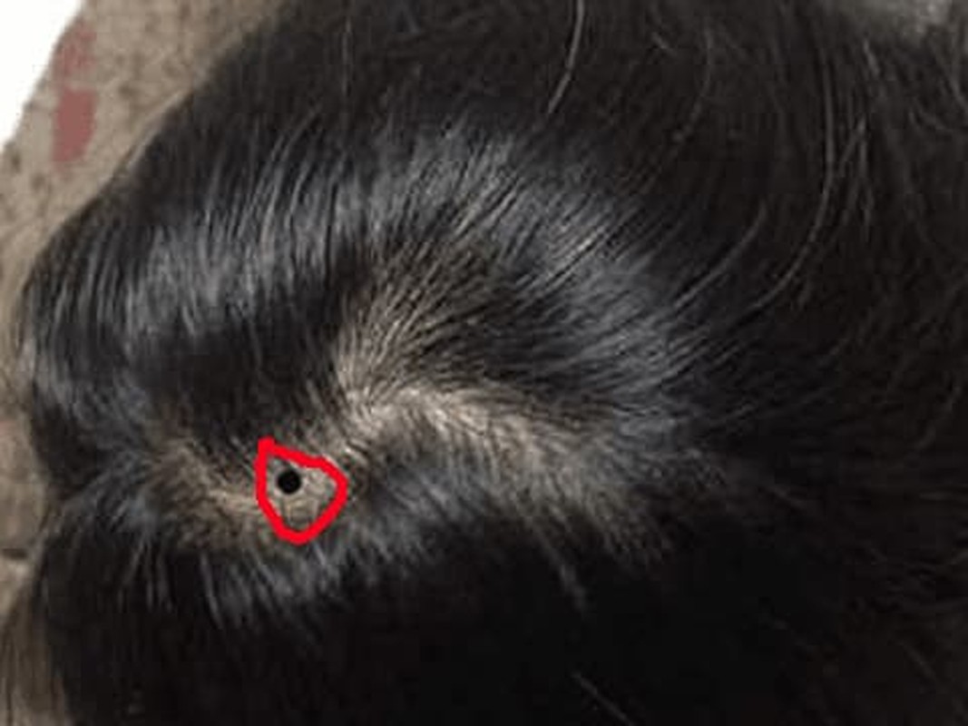 Người có 4 nốt ruồi này vừa giàu vừa sang, cả đời phú quý - Hình 3 Nguoi co 4 not ruoi nay vua giau vua sang, ca doi phu quy-Hinh-3