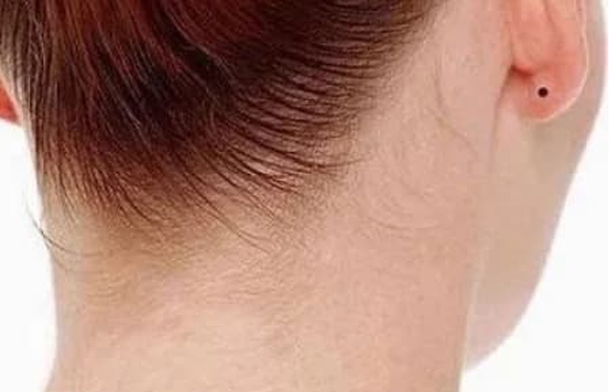 Người có 4 nốt ruồi này vừa giàu vừa sang, cả đời phú quý - Hình 5 Nguoi co 4 not ruoi nay vua giau vua sang, ca doi phu quy-Hinh-5