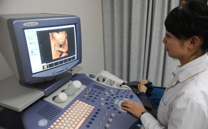 Siêu âm thấy con nhoẻn miệng cười, bố khen đáng yêu, bác sĩ: amp;#34;Em bé không ổn, mẹ chuẩn bị tinh thầnamp;#34; - 2