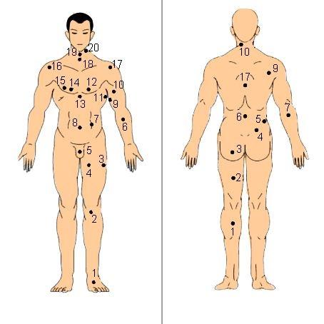 Nốt ruồi bàn tọa - họa phúc khôn lường: Đúng sai thế nào?-1