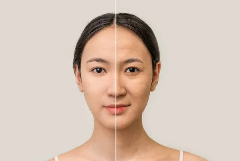 Việc chăm sóc da không đúng cách rất dễ dẫn đến tác dụng ngược cho làn da, khiến da ngày một tệ đi vì lão hoá thay vì đẹp lên.