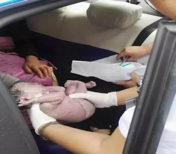 Bác sĩ thực hiện ngay thủ thuật cắt dây rốn khẩn cấp ngay trong khoang xe.