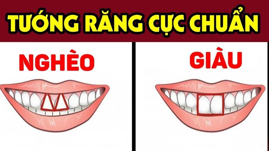 Người có 4 tướng răng này tình tiền đều khổ, dễ cô độc khi về già-1