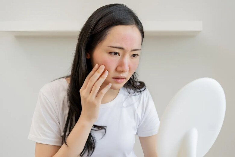 Nám da, sạm da cũng có thể là dấu hiệu của tiền tiểu đường. (Ảnh minh họa).