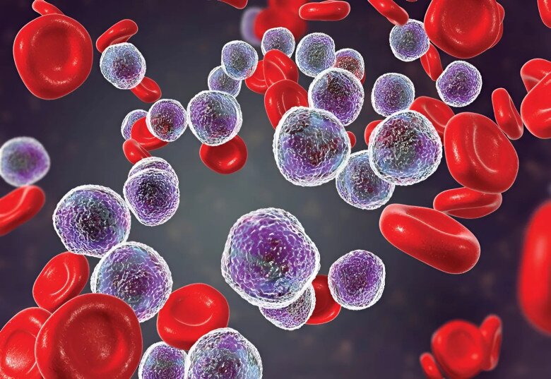Bệnh bạch cầu lymphoblastic cấp tính là một căn bệnh nguy hiểm và rất hiếm gặp. (Ảnh minh họa).