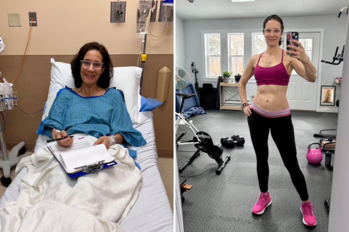 Bà Hershey chuẩn bị phẫu thuật cắt bỏ thận ngày 3/7/2024 (trái), tập thể thể dục sau 8 tháng (phải). Ảnh: WP