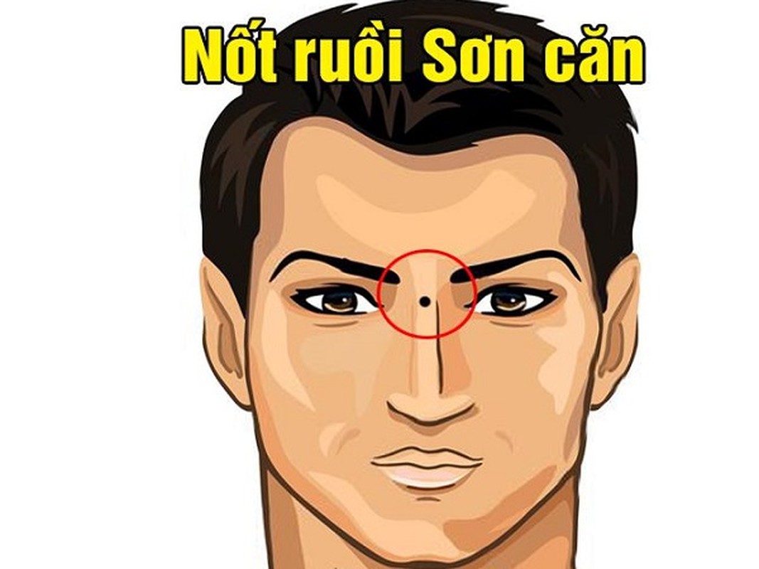 10 nốt ruồi lận đận: Ai có một đời xui xẻo, dễ tai ương - Hình 11 10 not ruoi lan dan: Ai co mot doi xui xeo, de tai uong-Hinh-11