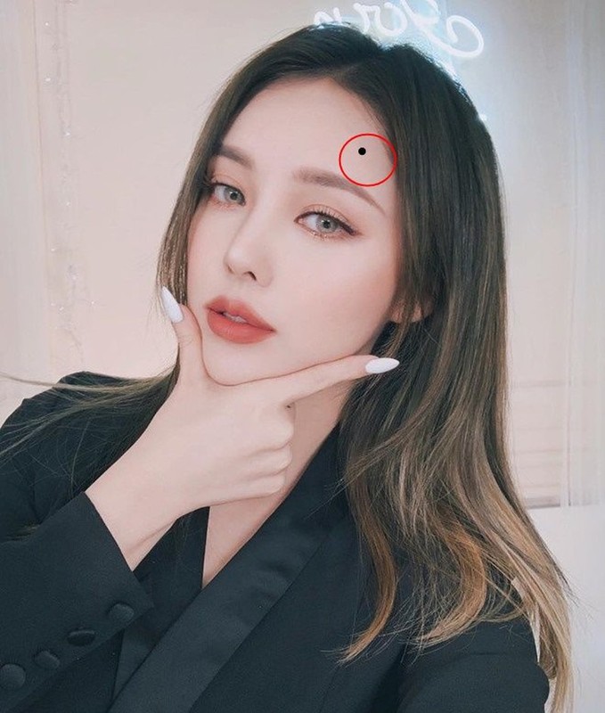 10 nốt ruồi lận đận: Ai có một đời xui xẻo, dễ tai ương - Hình 12 10 not ruoi lan dan: Ai co mot doi xui xeo, de tai uong-Hinh-12