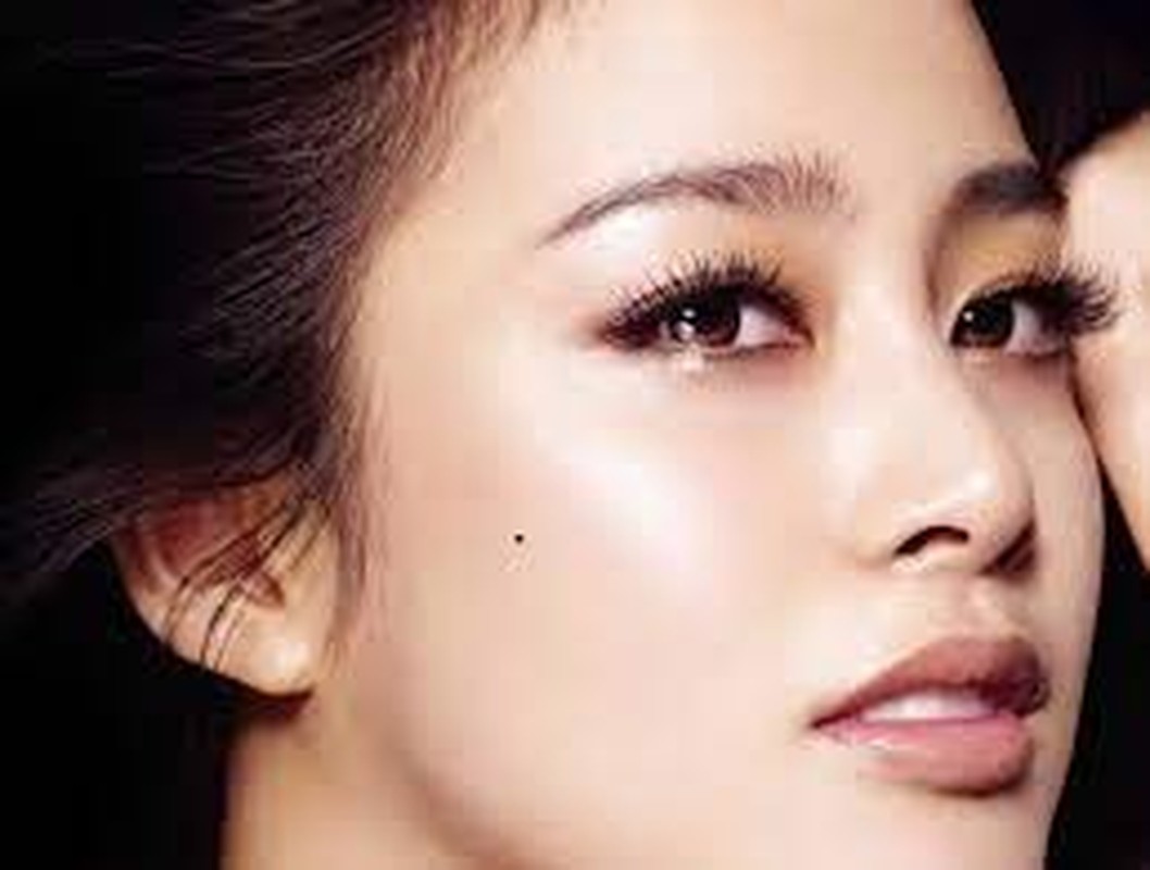 10 nốt ruồi lận đận: Ai có một đời xui xẻo, dễ tai ương - Hình 5 10 not ruoi lan dan: Ai co mot doi xui xeo, de tai uong-Hinh-5