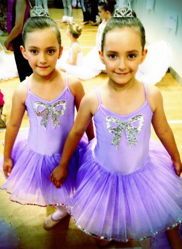 Cặp sinh đôi mắc bệnh hiếm, hai dây rốn đan nhau như tết tóc vẫn sống sót kỳ diệu, chào đời cực xinh - 4