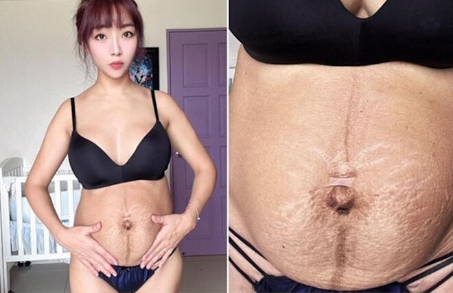 Hoa hậu bikini đẹp nhất thế giới 5 năm sinh 4 con, bị chê bụng quá xấu, sau PTTM ai nhìn cũng câm nín - 6