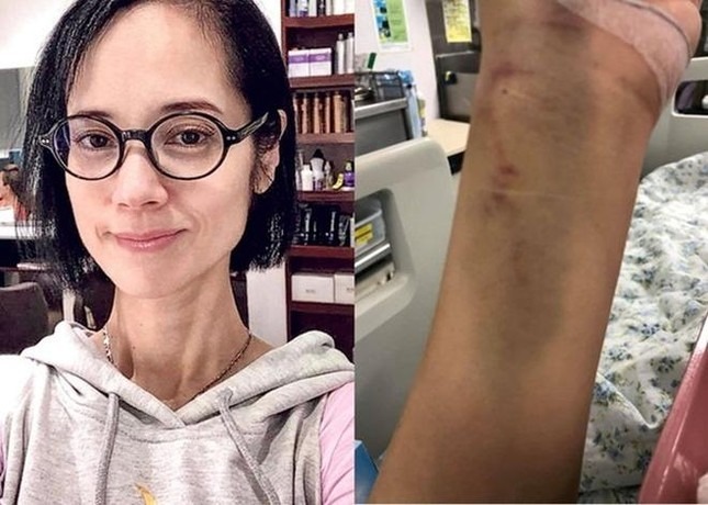 Nhan sắc tàn tạ, sức khỏe suy yếu của Trịnh Diễm Lệ khiến không ít người xót xa.