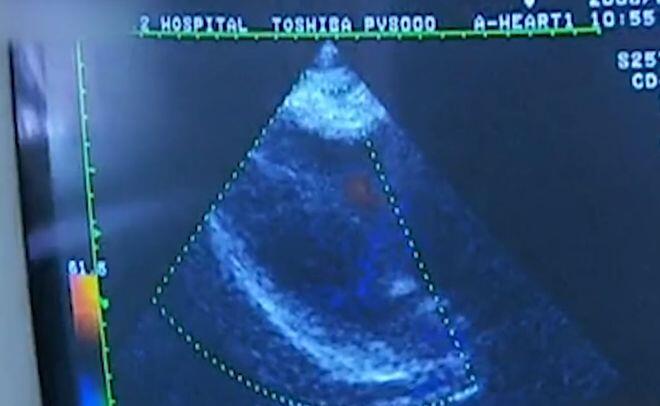 Mang thai 8 tháng, mẹ bầu nhập viện sinh mổ nhưng bác sĩ không thấy thai nhi đâu, lý do khiến nhiều người sợ hãi - 3