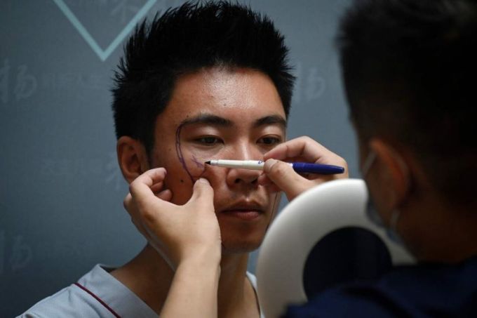 Bác sĩ vẽ lên khuôn mặt một chàng trai Trung Quốc, trước khi làm phẫu thuật, tại một phòng khám ở Bắc Kinh, năm ngoái. Ảnh:AFP.
