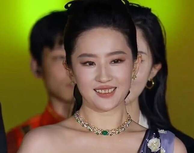 Lưu Diệc Phi bị soi khuyết điểm nụ cười hở lợi và phần răng khấp khểnh, không sáng màu