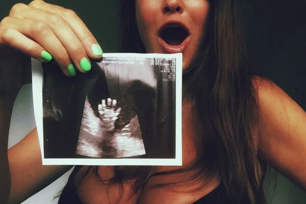 Mẹ bầu đi siêu âm thai, ngạc nhiên thấy em bé trong bụng giơ bàn tay 5 ngón, nghe bác sĩ nói liền xúc động - 3
