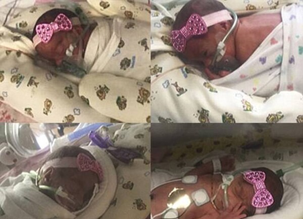 Nghĩ mang song thai, người phụ nữ hoang mang khi 3 lần siêu âm bác sĩ lại thông báo “còn em bé khác” - 3