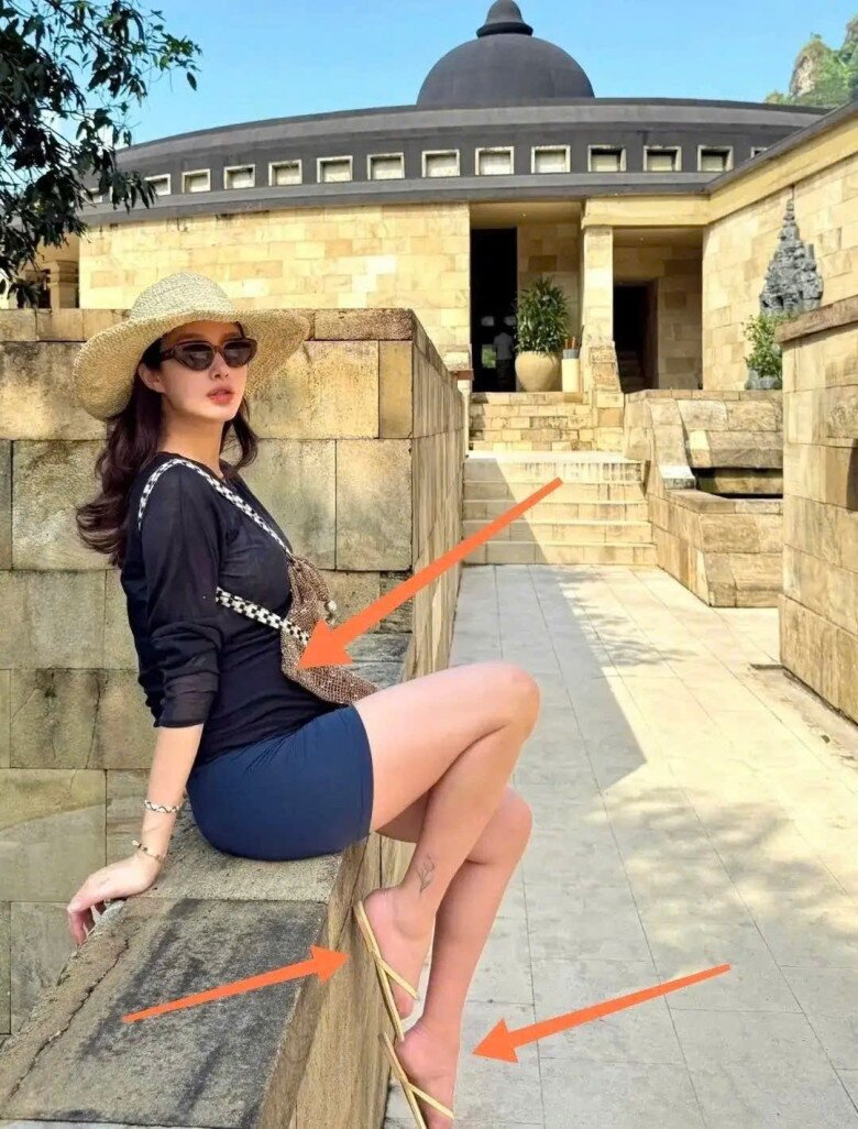 Truyền thông Trung Quốc dành sự chú ý vào đôi chân sưng phù của bà bầu 9X.