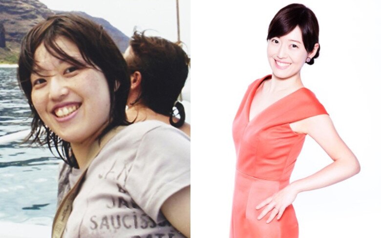 Hình ảnh trước và sau khi giảm cân thành công của bác sĩ.