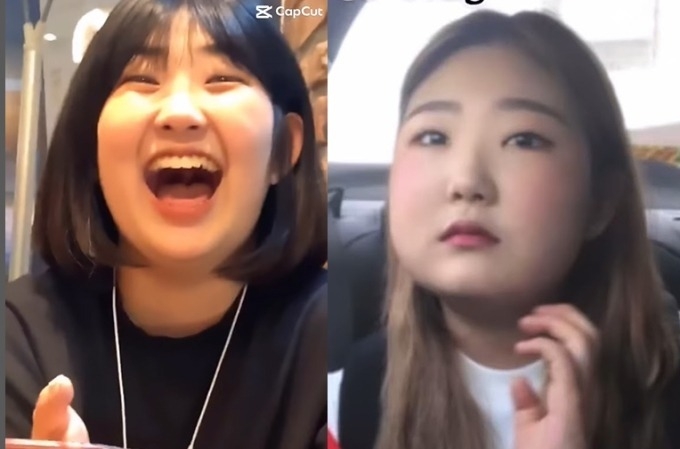 Choi Jun Hee thời điểm phát tướng do bệnh Lupus ban đỏ.