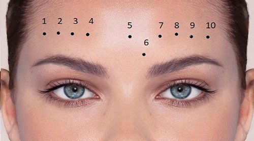 7 not ruoi vuong tuong tu 10 doi moi co, dung dai tay di-Hinh-4