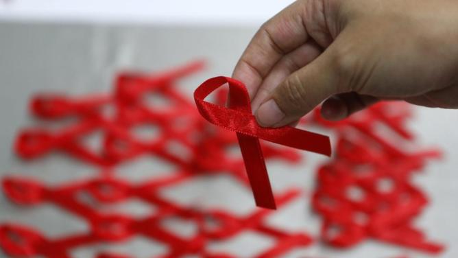 Experts say Australia is on track to virtually eliminate HIV but concerns remain for late detection. (EPA PHOTO)