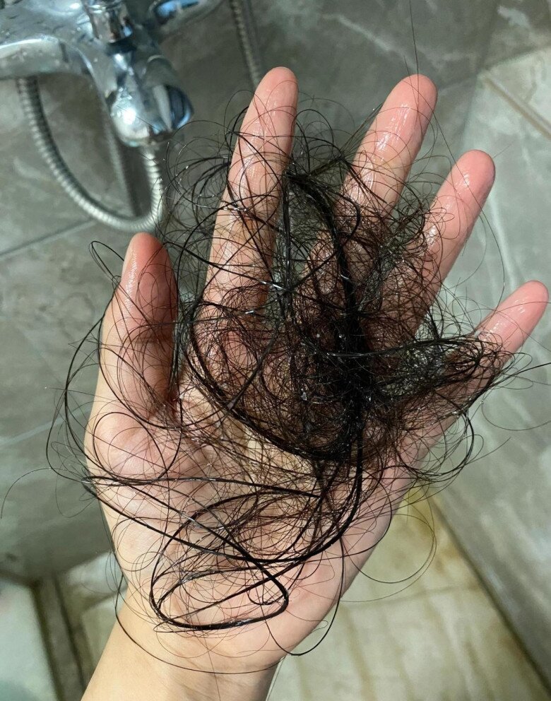 Tại sao lau dọn mỗi ngày nhưng nhà vẫn đầy lông bụi? Học cách này, nhà bạn sẽ sạch bong kin kít - 3