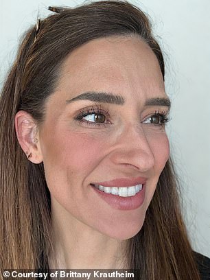 Tiêm botox vào một nửa khuôn mặt để xem ảnh hưởng thế nào đến vẻ bề ngoài: Nữ y tá "gây sốt" khi hé lộ kết quả!- Ảnh 5.