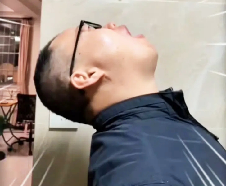 Ngửa đầu, súc miệng mạnh vài lần có thể loại bỏ xương cá. Ảnh: Aboluowang