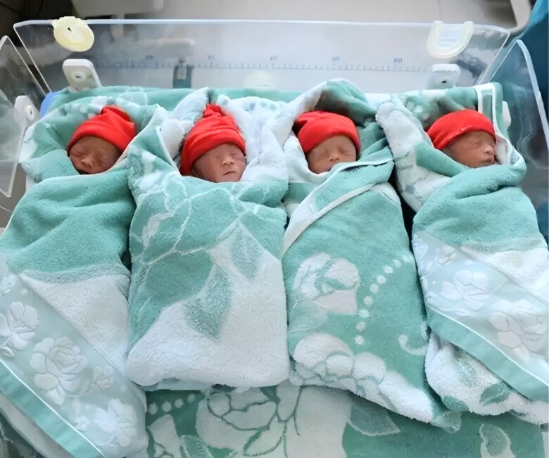 3 bé trai và 1 bé gái chào đời với chỉ số khoẻ mạnh, bác sĩ nhận định ca sinh hiếm với tỷ lệ 1/10.000 - Ảnh minh hoạ.