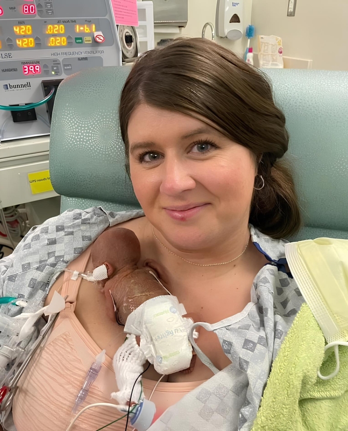 Nash trong lòng mẹ khi mới chào đời. Ảnh: guinnessworldrecords