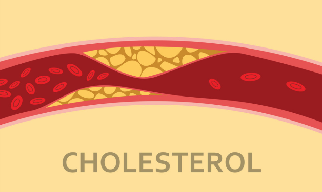 Tiêu thụ măng tây có thể giúp giảm cholesterol.