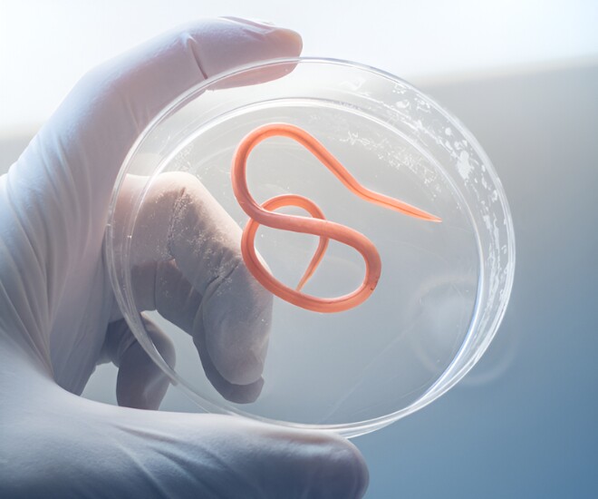 Một số thực phẩm có khả năng tiêu diệt nhiều loại vi khuẩn, virus và ký sinh trùng.(Ảnh minh hoạ).