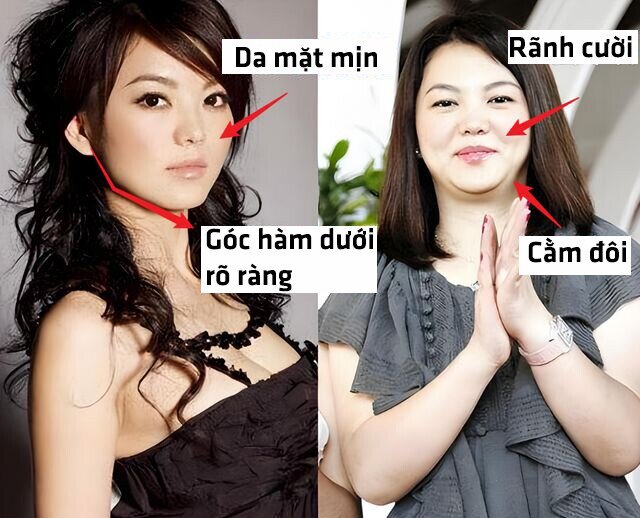 Người lười vận động càng lớn tuổi càng dễ sưng phù mặt, mất đường nét.