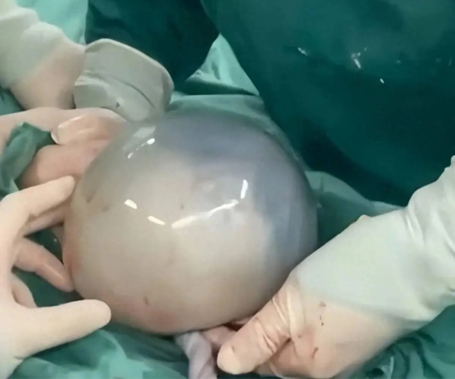 Em bé chào đời trong bọc điều khiến người bố vỡ oà.