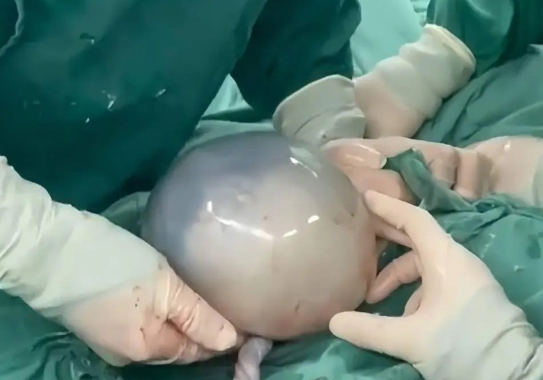 Đội ngũ y tế mỉm cười chúc mừng gia đình nhỏ.